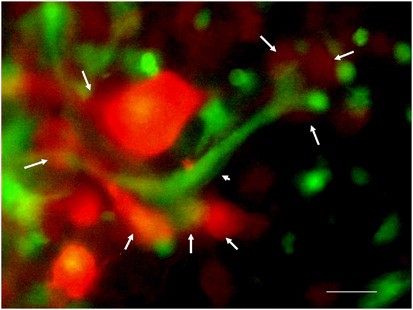 Fluorescent imaging of cancer cells